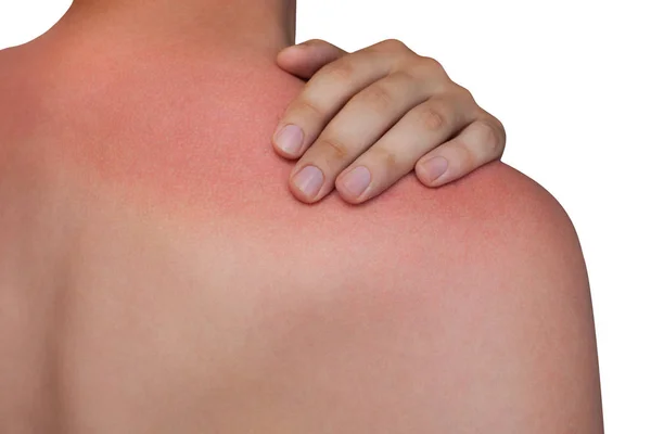 skin damage from the sun